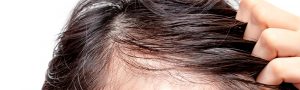 efecto shedding