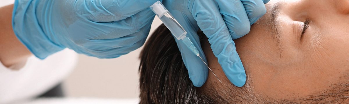 Tratamiento de mesoterapia con dutasteride