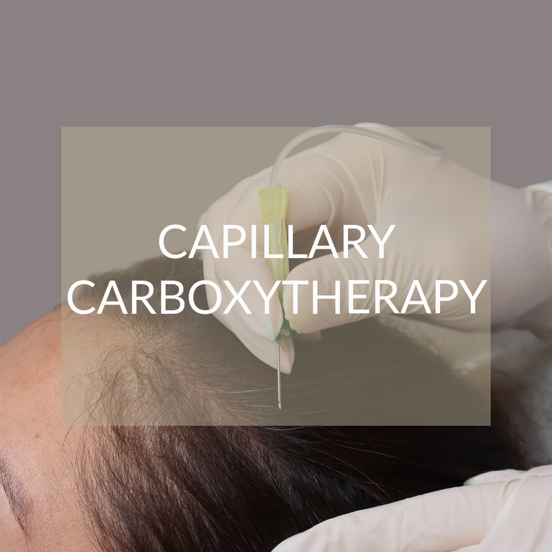carboxytherapy capillary madrid