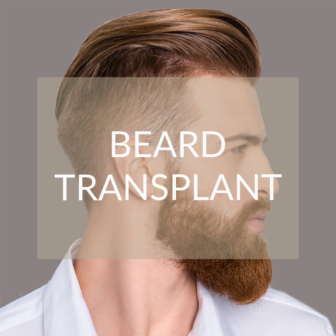 beard transplant México