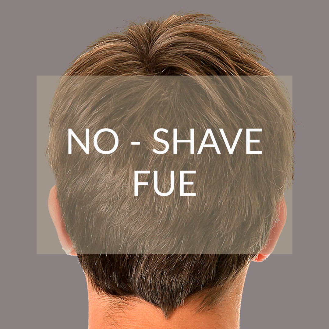 No Shave FUE