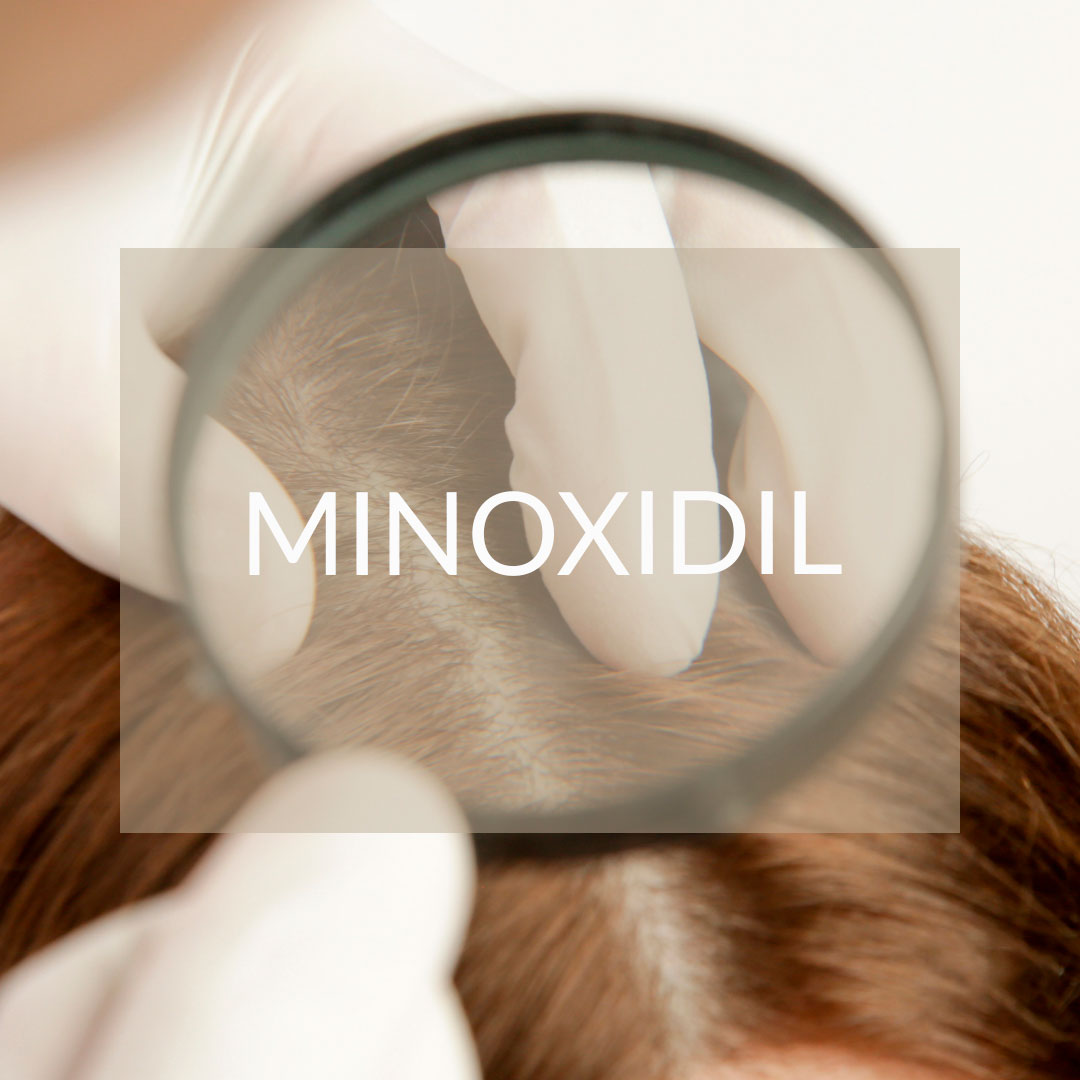 minoxidil tratamiento farmacológico capilar