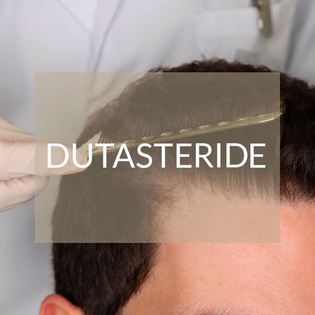 dutasteride oral medication hair transplant madrid