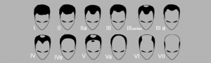 Clasificación de la alopecia