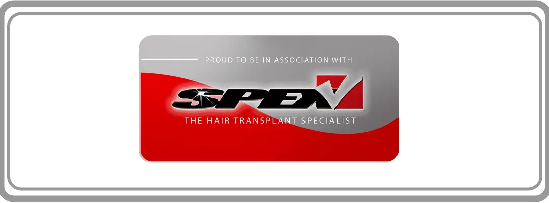 Spex Hair Transplant Espinosa Custodio
