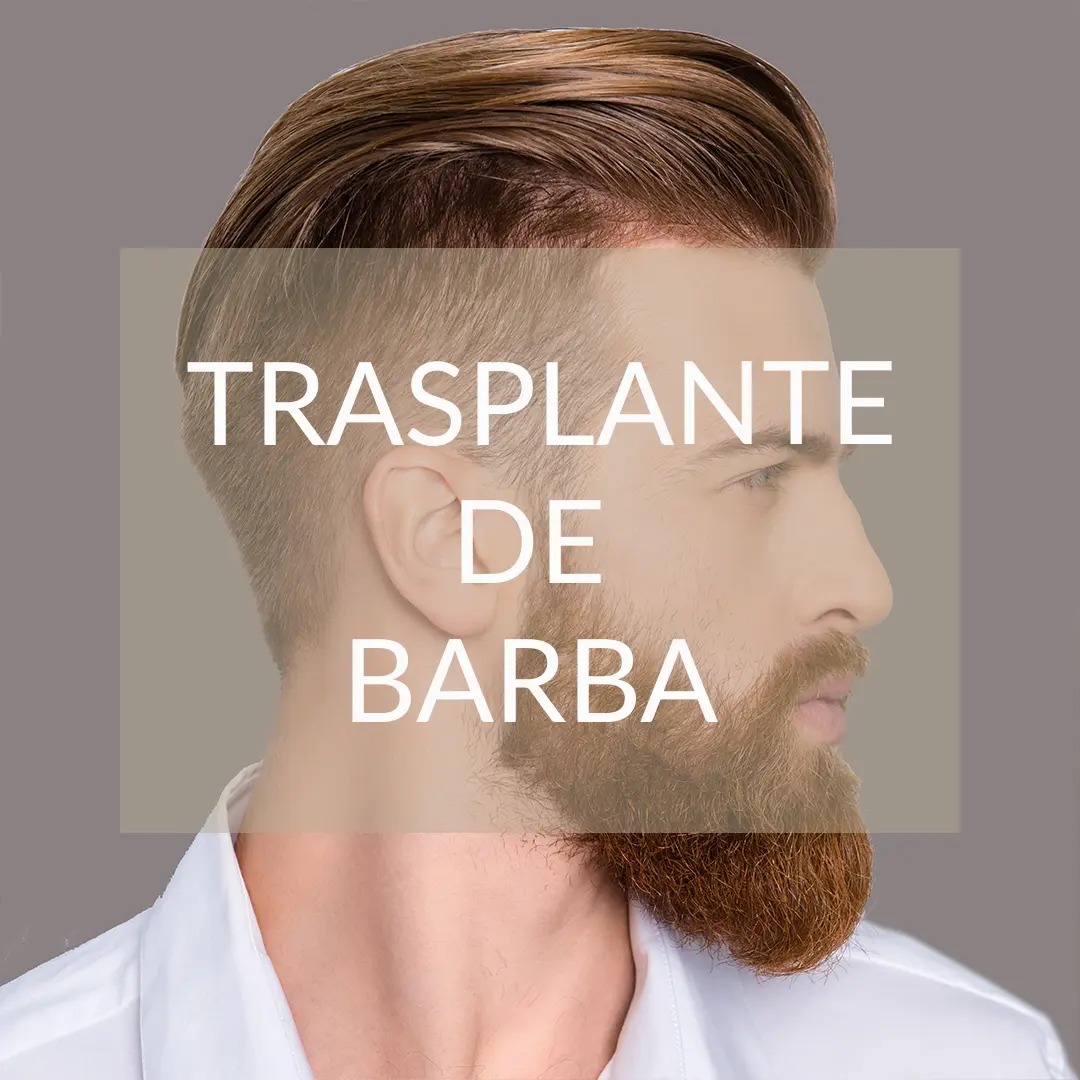 Trasplante de barba Dr. Espinosa Custodio