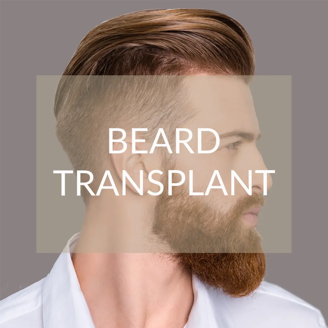 Beard Transplant Dr. Espinosa Custodio