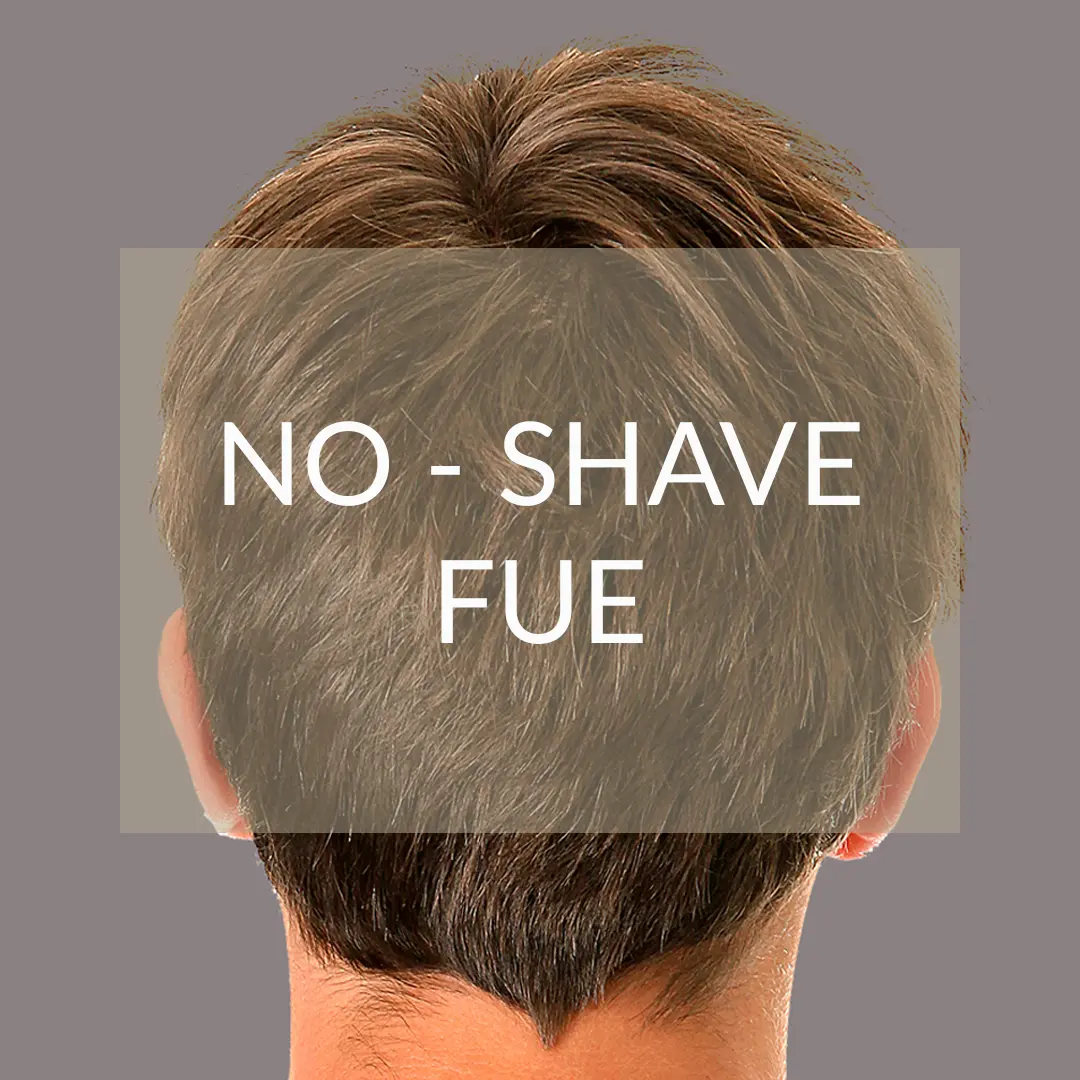 Unshaven hair graft DHI technique