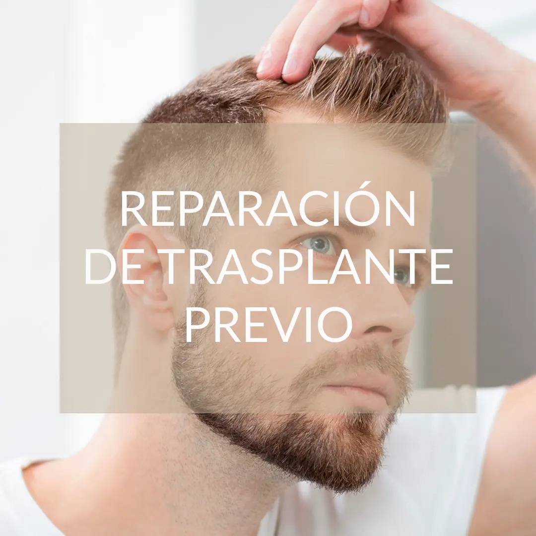 Restauración de trasplante capilar previo